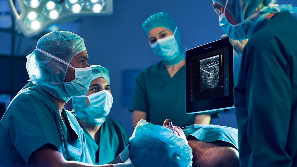 Le personnel médical observe un bloc du plexus infraclaviculaire guidé par échographie sur un moniteur dans le bloc opératoire