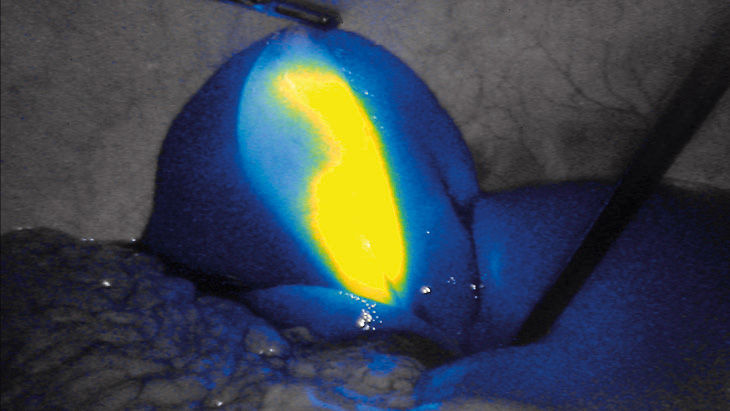 Intensité FI – Technologie d’imagerie par fluorescence 3D